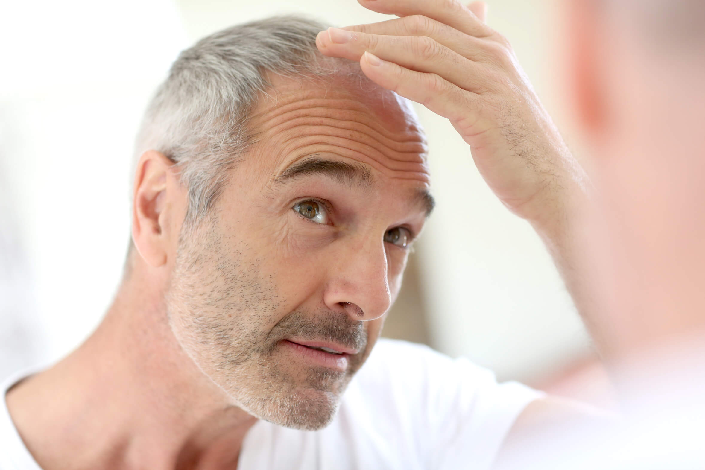 Hair Loss In Men Total Hair Loss Solutions Leeds